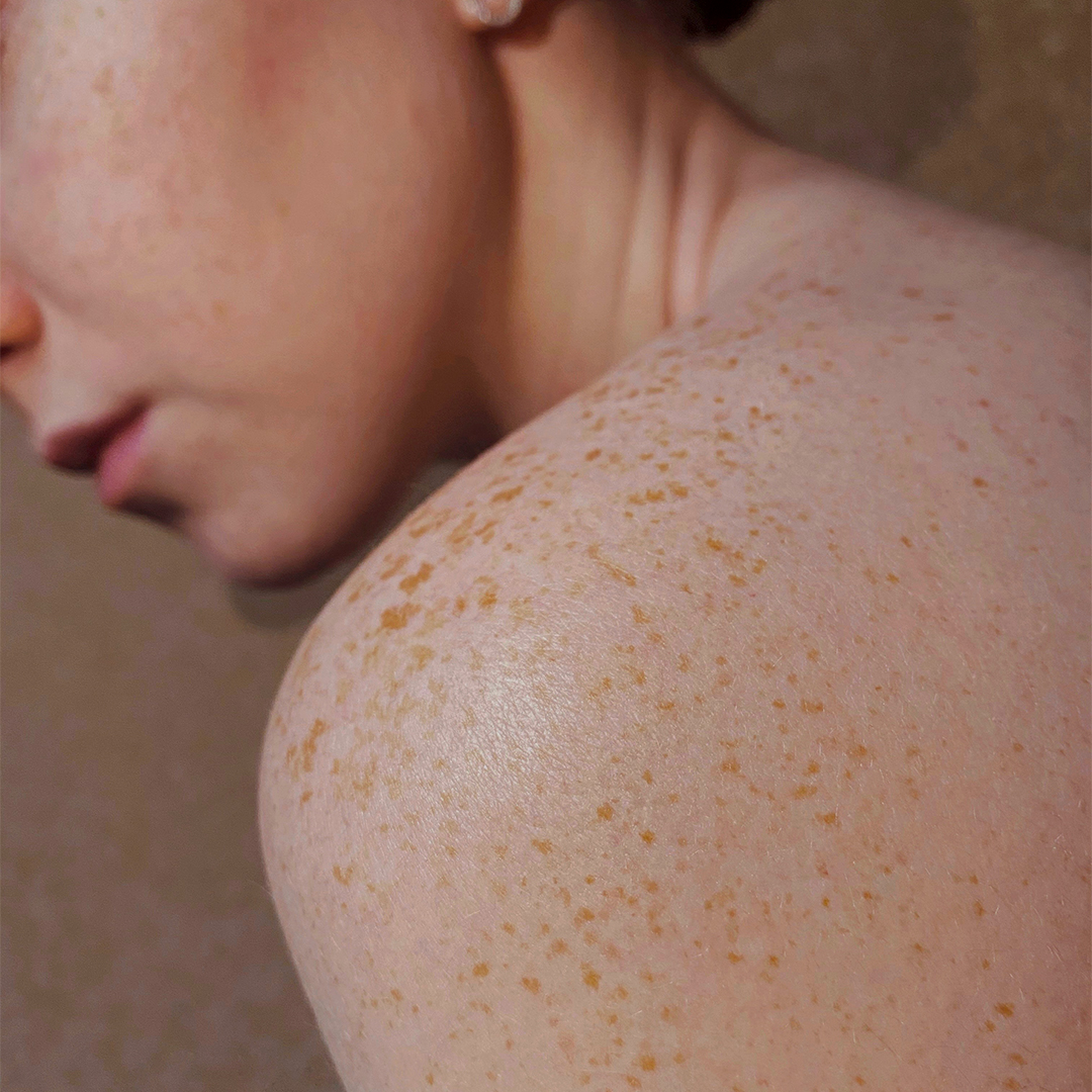 Cetaphil Germany Social Media Relaunch